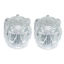 Picture of Phoenix Faucets  2-Pack Clear Acrylic Knob Style Faucet Handle PF287015 10-0053                                              